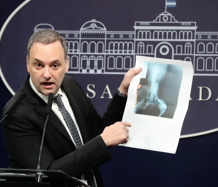 El Gobierno comenzó a auditar 400.000 pensiones por invalidez laboral otorgadas en los últimos años